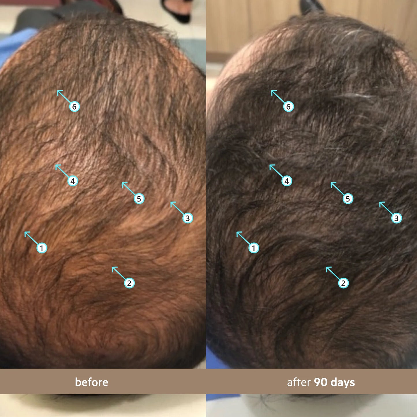 Maximum Hair Density Serum